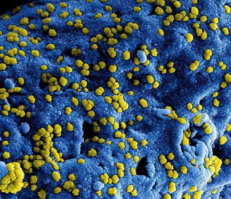 Coronavirus - Foto: National Institute of Allergy and Infectious Diseases (NIAID)